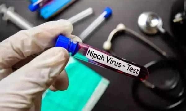 ویروس نیپا