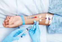 سرطان پستان